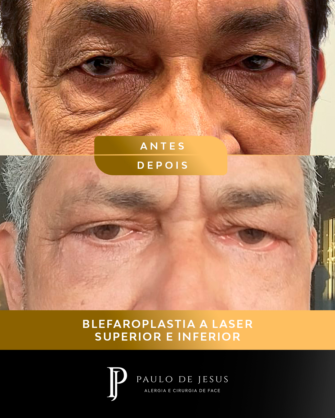Prancheta 1